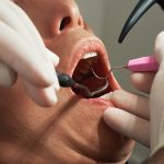Chirurg stomatolog we Wrocławiu – Twoje zdrowie w najlepszych rękach